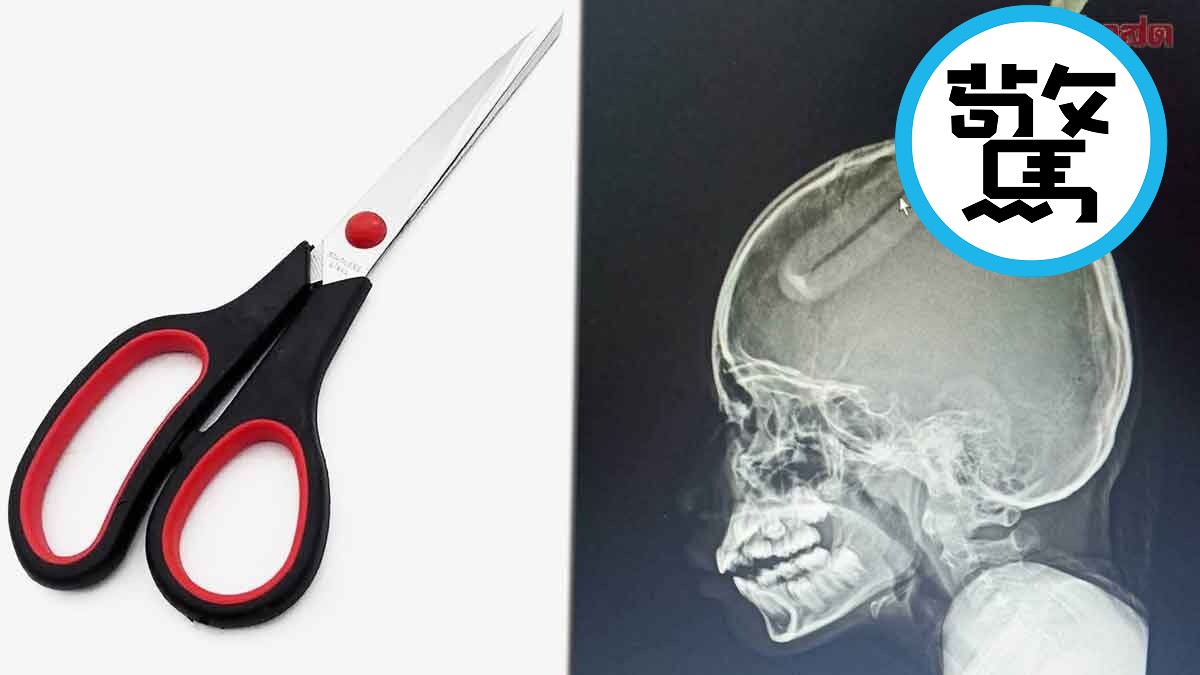 4歲男童被電視暴力帶壞！模仿角色「射飛刀」，直接插進姐姐頭部。（翻自 AMARINTV）