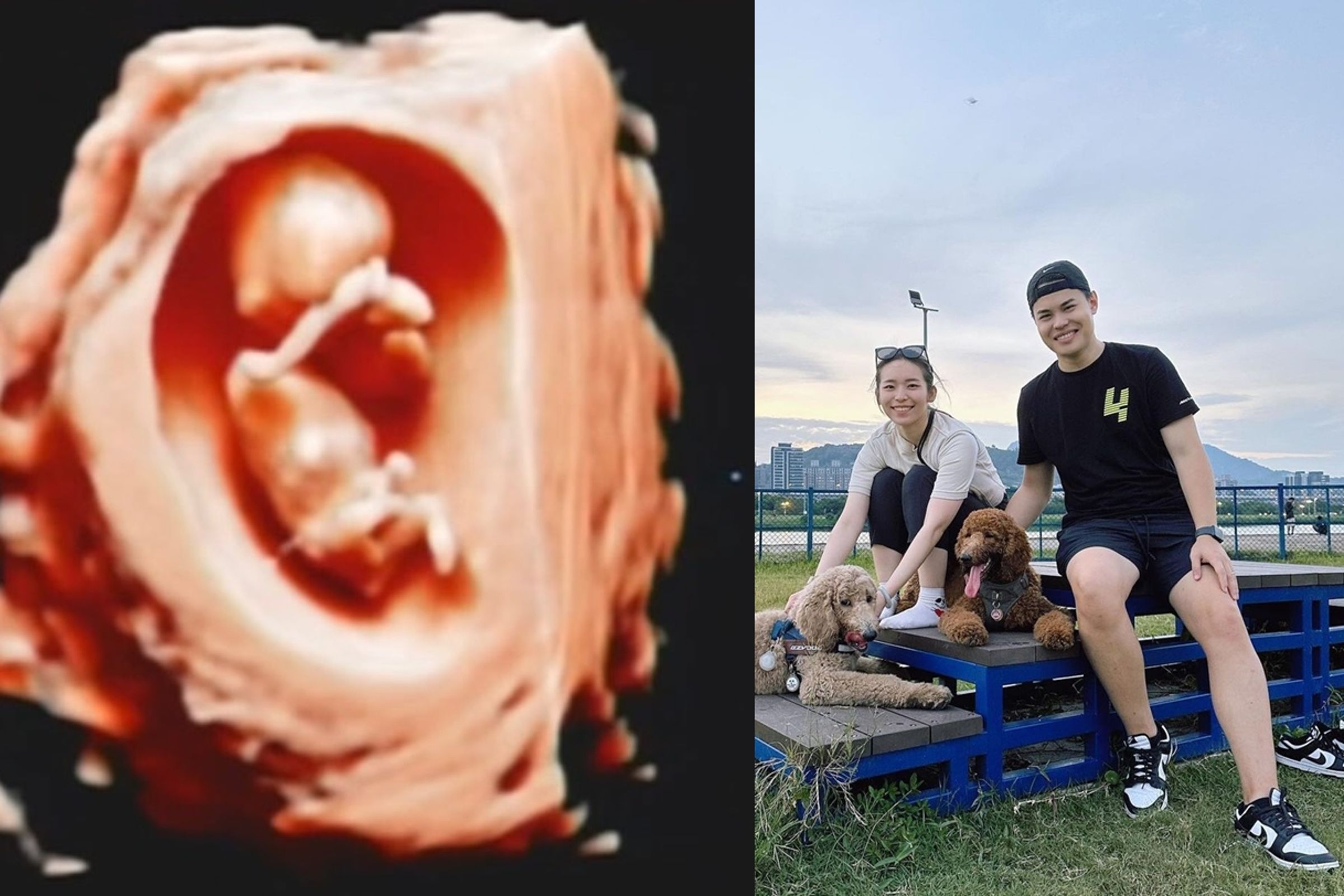 聖結石與老婆不時在社群分享生活,他日前才在社群曬出胎兒的超音波照,宣布自己即將當爸爸。(翻攝網路)