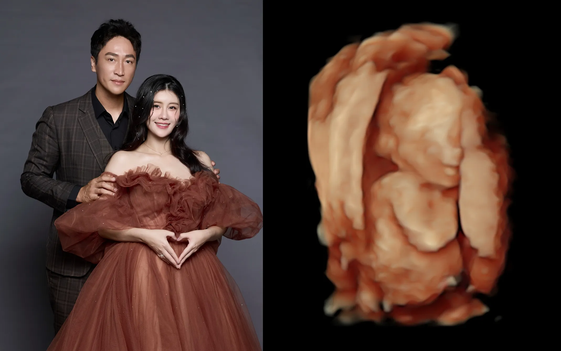 女星林真亦在寶寶滿21週當天，忍痛做出引產的決定。（翻攝自林真亦 IG）