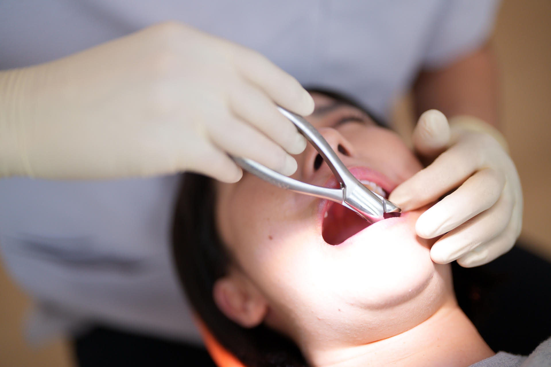 一名吳姓少婦在醫院拔智齒，沒想到卻因醫療疏失，最後走上絕路。（示意圖非當事人，photoAC）