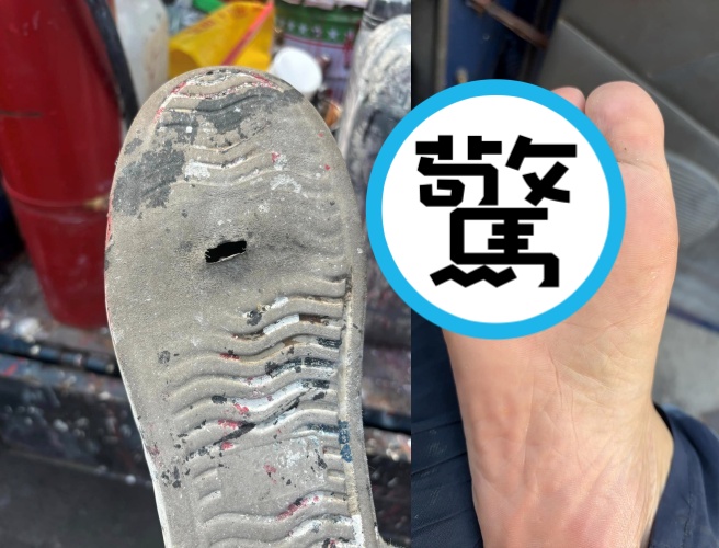 這名網友不僅鞋底被陽光曝曬的高溫地面融出一個洞，就連腳底也被燙傷。（翻攝自臉書 爆廢1公社）