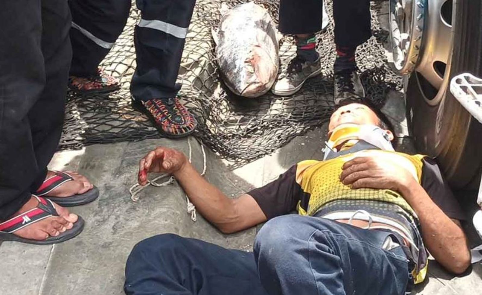 貨車司機頭部被鮪魚擊出一道5公分長的傷口,但幸好人還保持清醒。(翻攝自khaosod.co.th)
