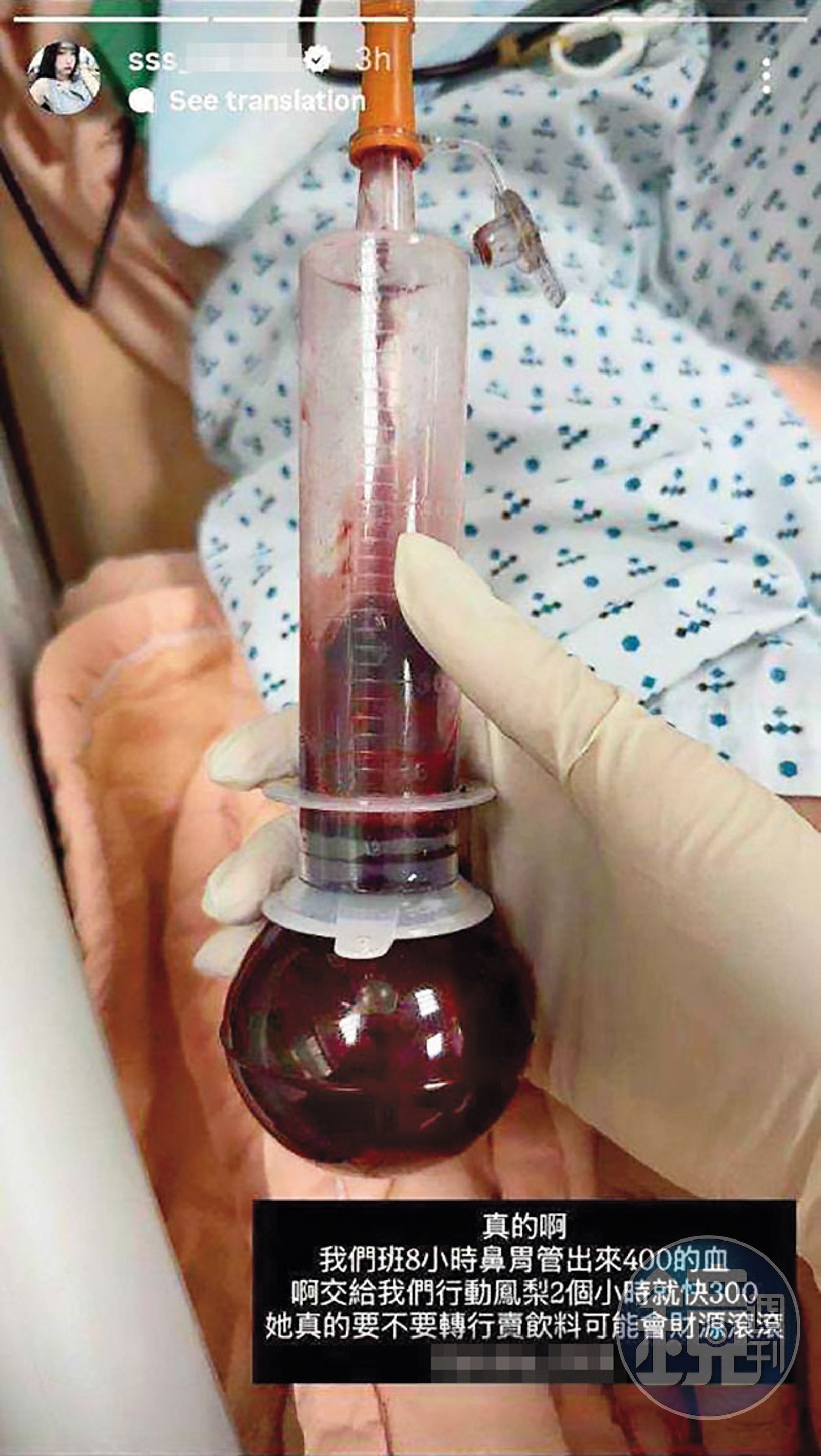 廖婉如因病患的鼻胃管血量過多，公開調侃當班的學妹。（讀者提供）