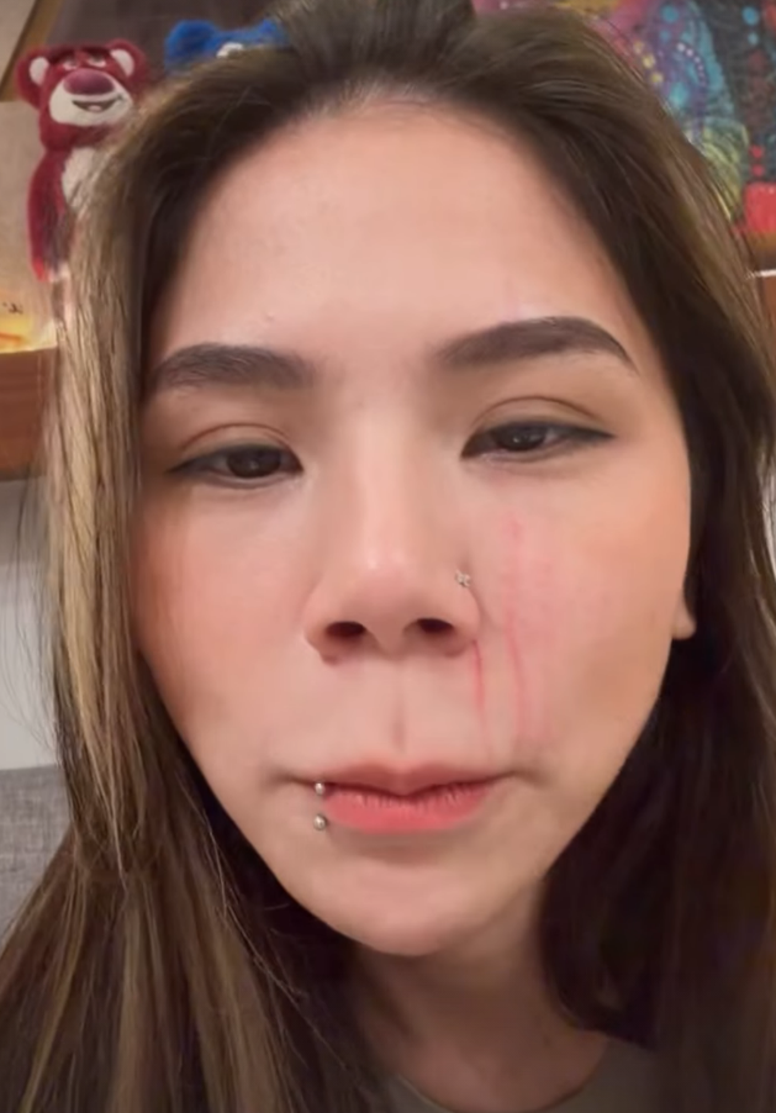 蕾菈臉上留下深深爪痕。（翻攝IG@la.112814）