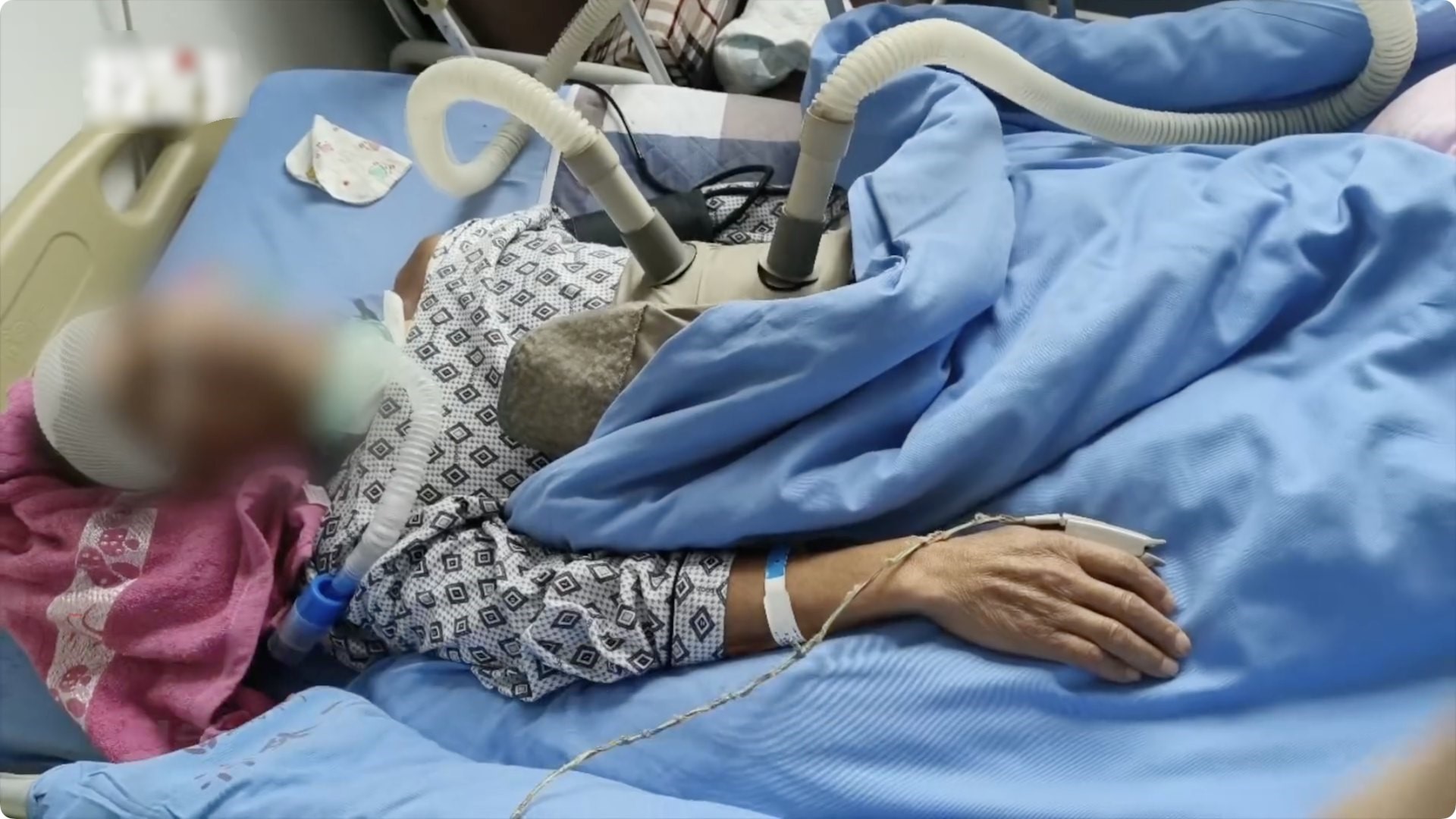 中國湖南一男子夜釣時,被人誤當為獵物,頭部中彈。(番社自微博)