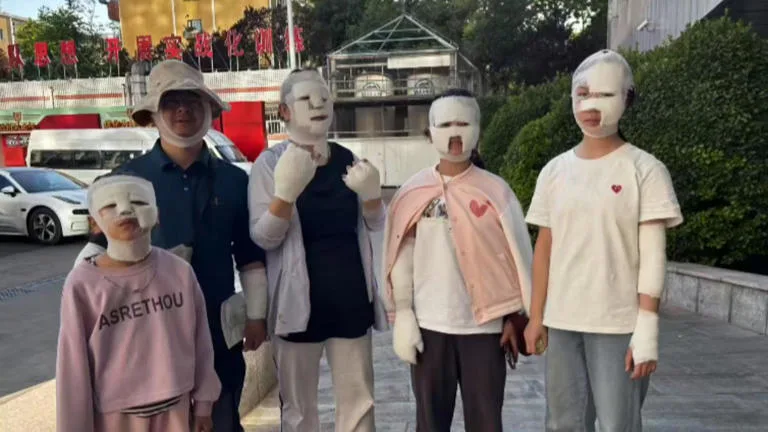 2家人相約戶外烤肉，未料僅用過2次的卡式爐竟突爆炸，讓全家被炸成「木乃伊」。（翻攝自微博）