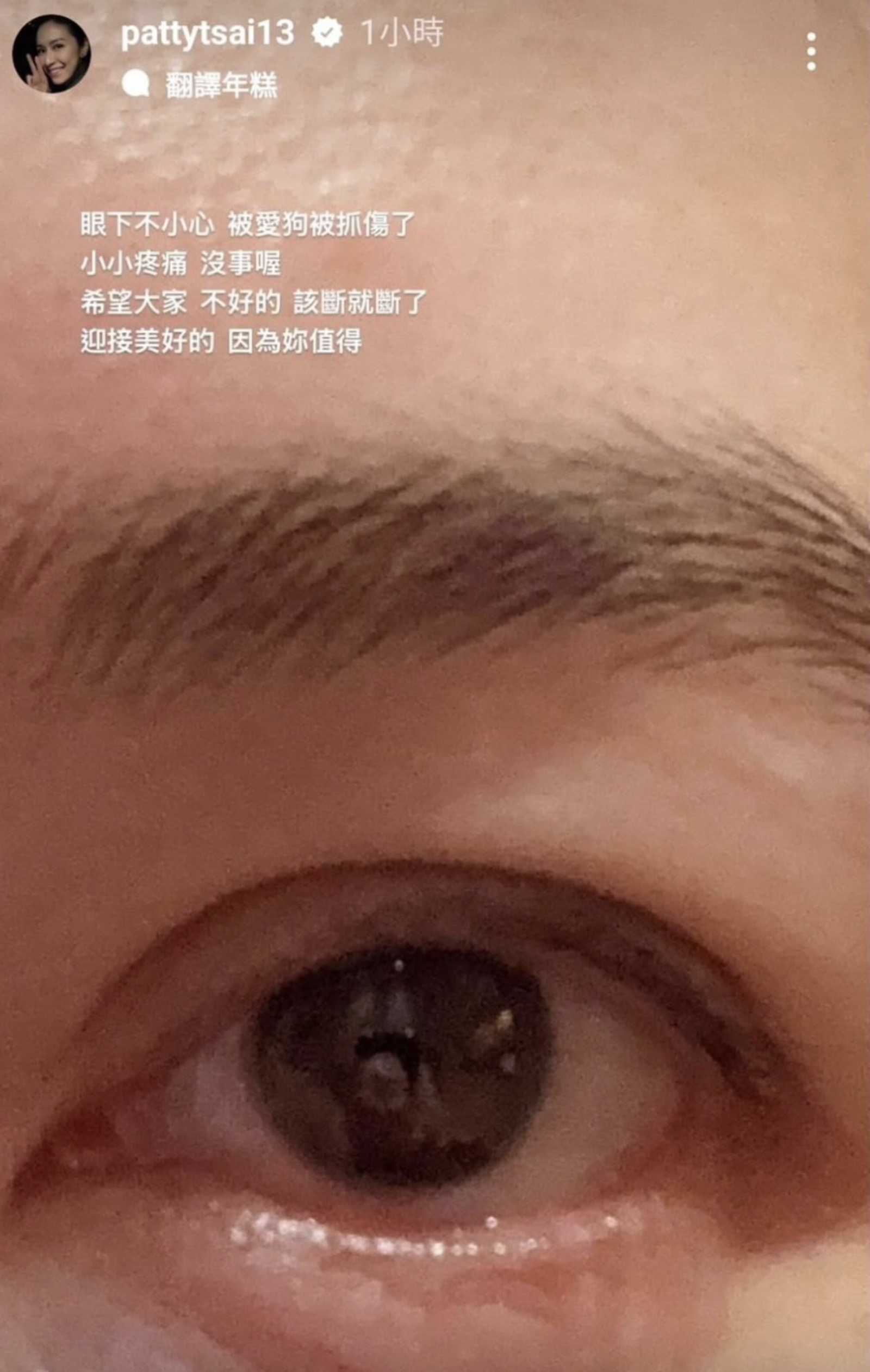 蔡依珊昨日在限時動態表示自己眼下被愛犬抓傷,又感嘆「該斷就斷了」,隨後刪除動態。(翻攝自Threads)