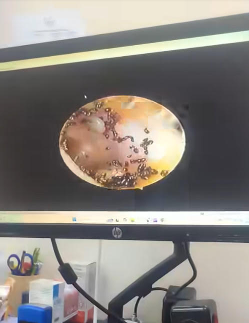 女童耳內可見密密麻麻的跳蚤寄生，畫面十分噁心。（翻攝臉書@Aqila Nasir）
