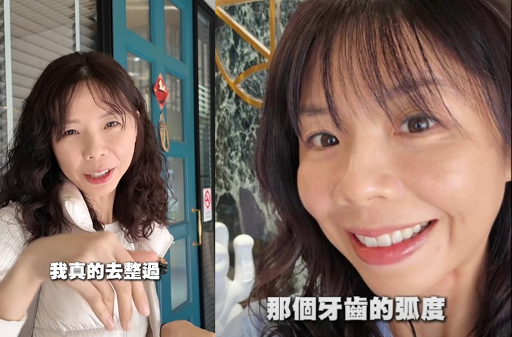 洪慈庸針對整形傳聞大方坦言有去整牙,目前對自己笑容更有自信。(翻攝臉書@洪慈庸)