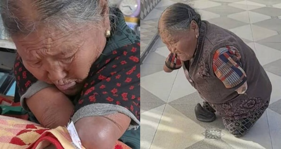 81歲的王玉氏雖天生無四肢,但她在農村生活中練就一身本領,無論是洗衣還是料理家務,皆靠著斷肢與嘴部動作克服。(翻攝自微博)