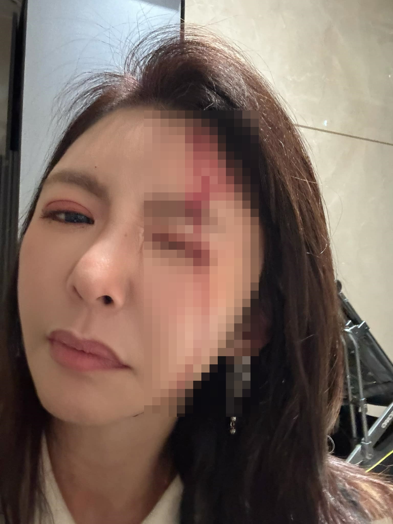 李芳瑜因為老公遭遇血光之災,所幸並無大礙。(翻攝自芳瑜 FiSha Lee臉書)