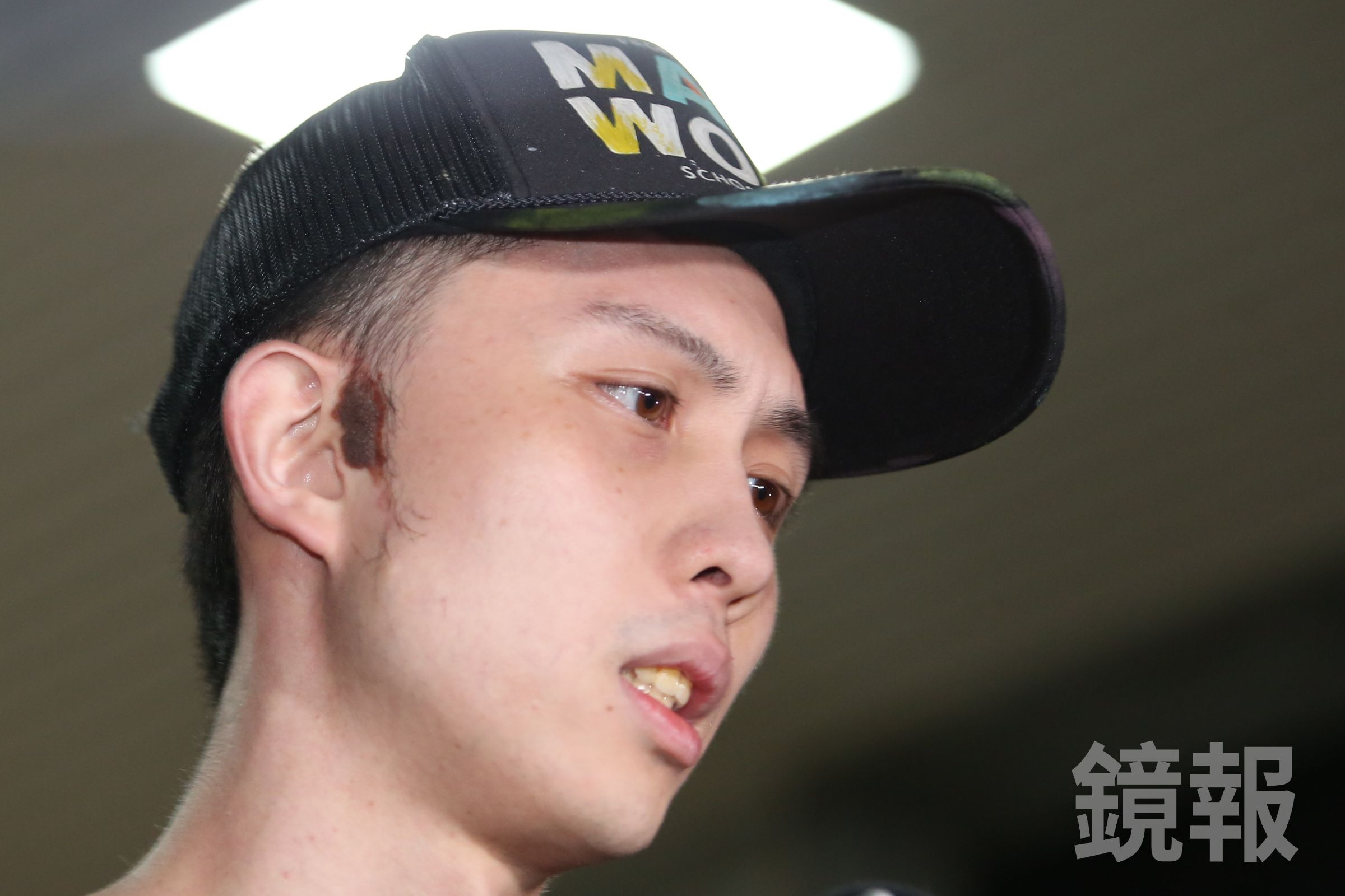 孫安佐右臉胎記一度被認為是傷痕，實際是胎記。（鏡報姜永年攝）