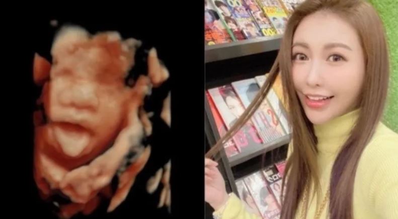 愷樂曬出超音波照片，疑似公開當媽喜訊。（翻攝自愷樂IG）