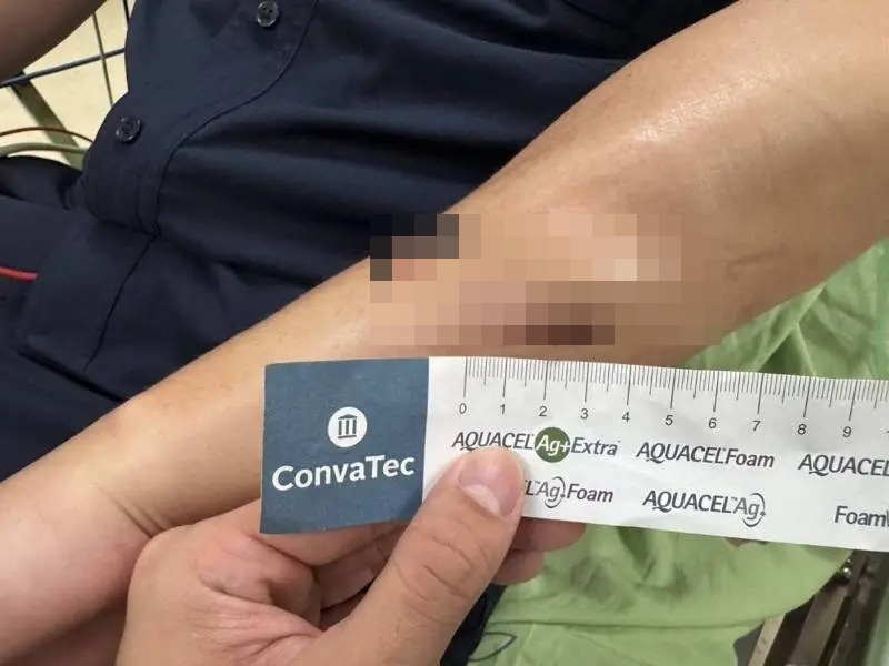受傷員警隨後送醫縫合,所幸意識清楚並無生命危險。(翻攝畫面)