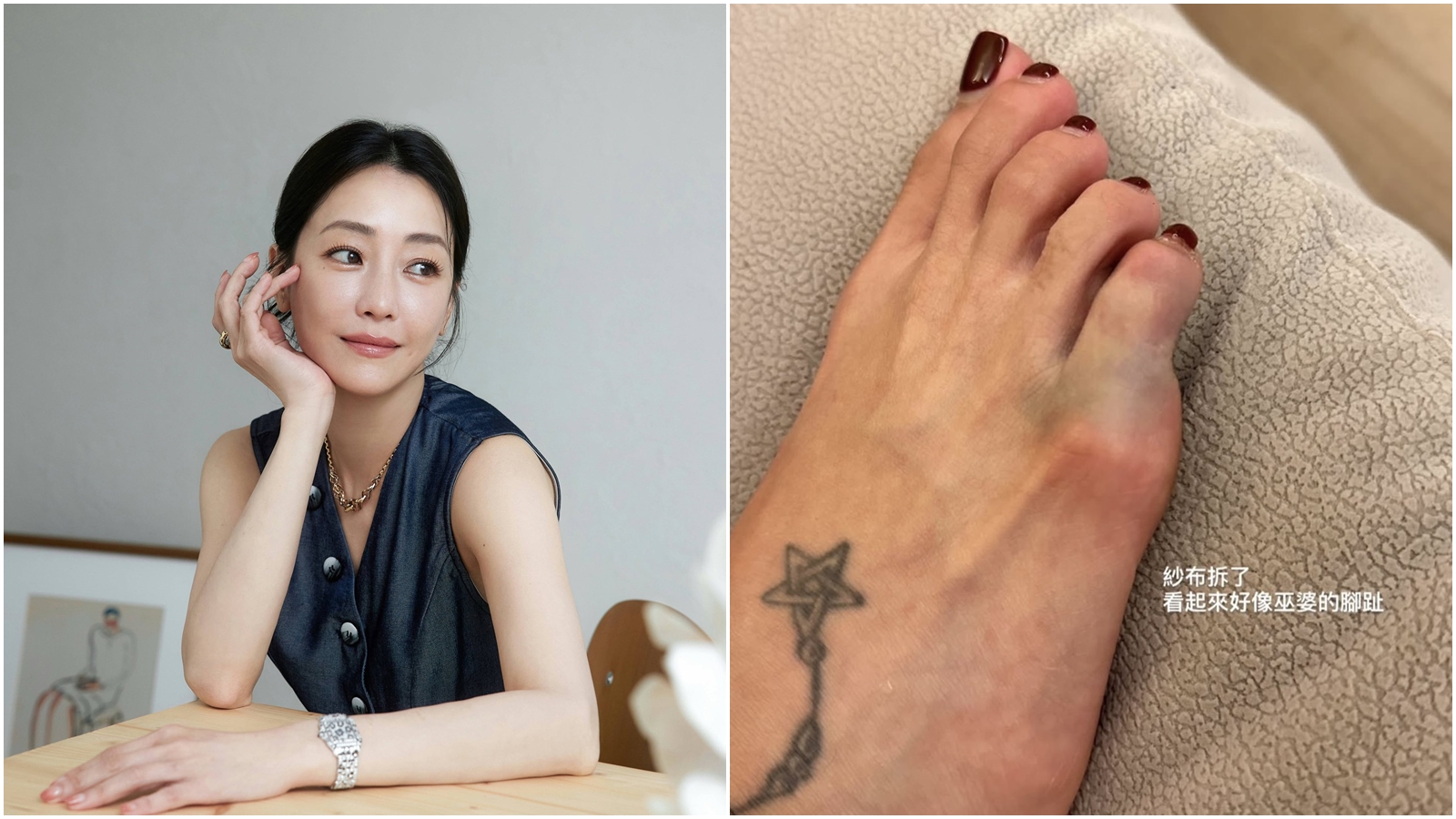 謝欣穎在IG分享腳骨折照。（翻攝自IG、臉書）