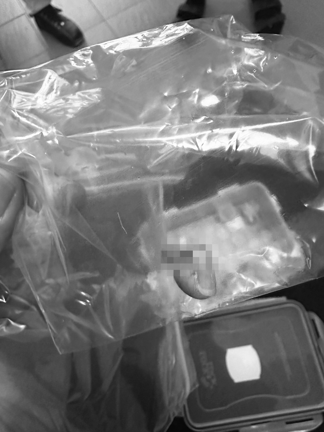 女騎士斷指不自知，直到新聞播出才驚覺自己手指不見。（翻攝自施晧軒｜豐榮里長臉書）