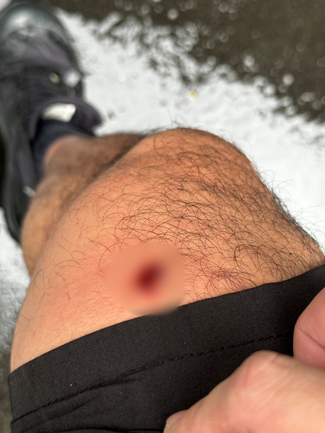 警方腿部遭子彈碎片反彈擊中受傷。（翻攝畫面）