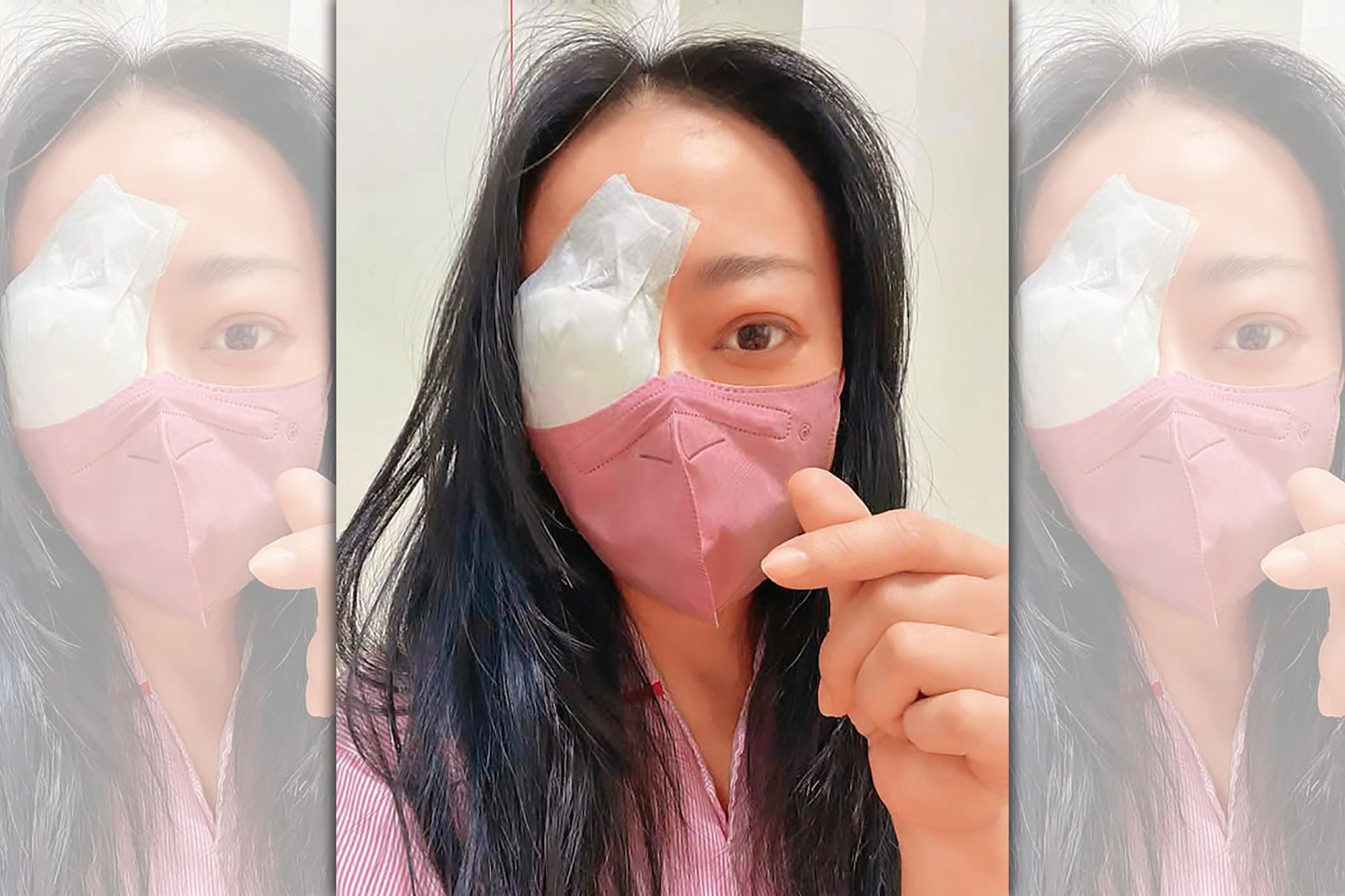 高慧君10月初因凸眼做眼窩減壓手術，進行全身麻醉、削眼骨，對治療結果她也預做最壞的心理準備。（翻攝自高慧君臉書）