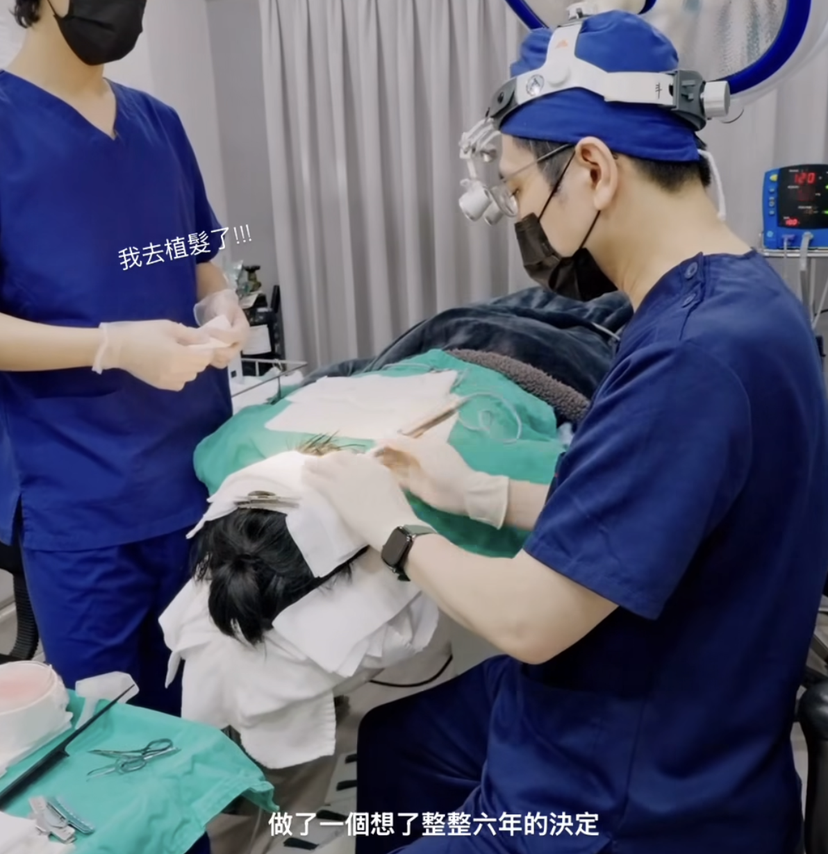 黃宏軒鼓起勇氣植髮。臉書