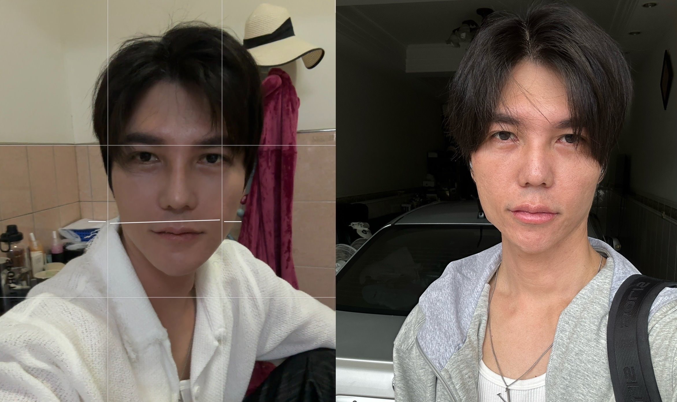 「口罩男」做了隆鼻、下巴整形、墊法令紋及豐額頭手術,整個人狀態極佳。(口罩男提供)