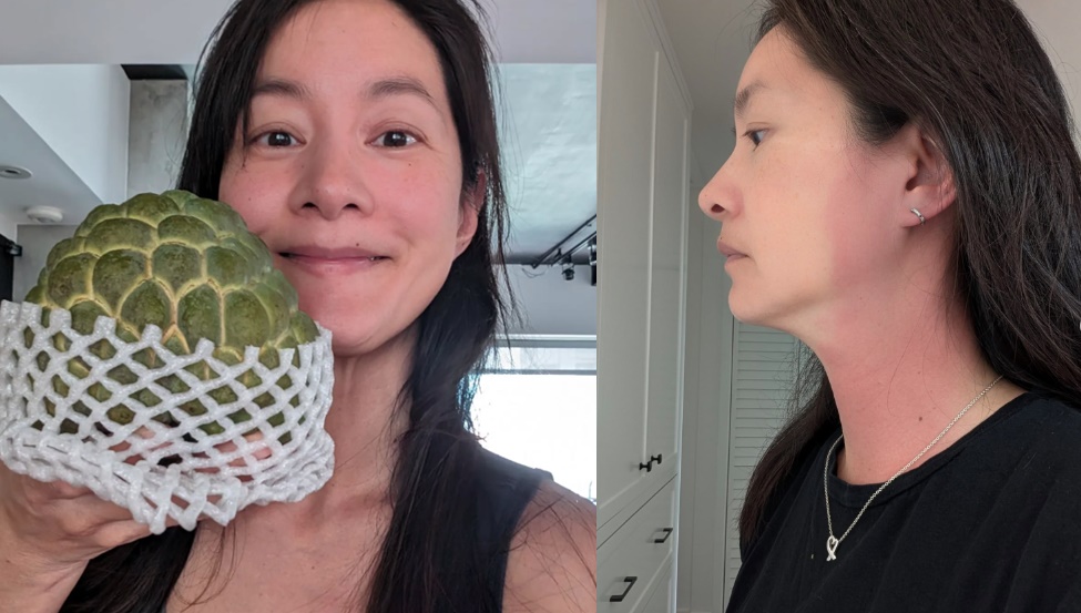 Janet表示自己突然發高燒、脖子到耳朵出現紅腫。（翻攝自IG＠janetagram）