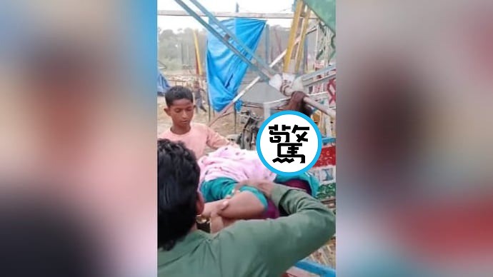 慎入！少女搭摩天輪長髮被捲入，「頭皮整片撕下」失血過多昏迷。（翻自X平台）