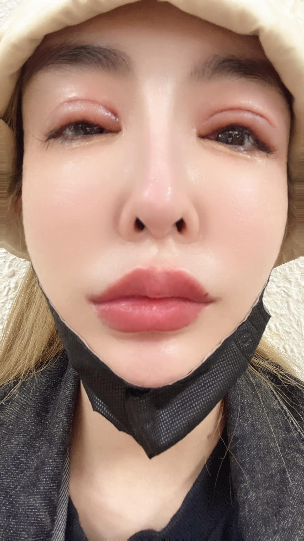 雪碧雙眼紅腫，網友看了嚇壞直呼「好像被家暴」。（翻攝自方祺媛臉書）