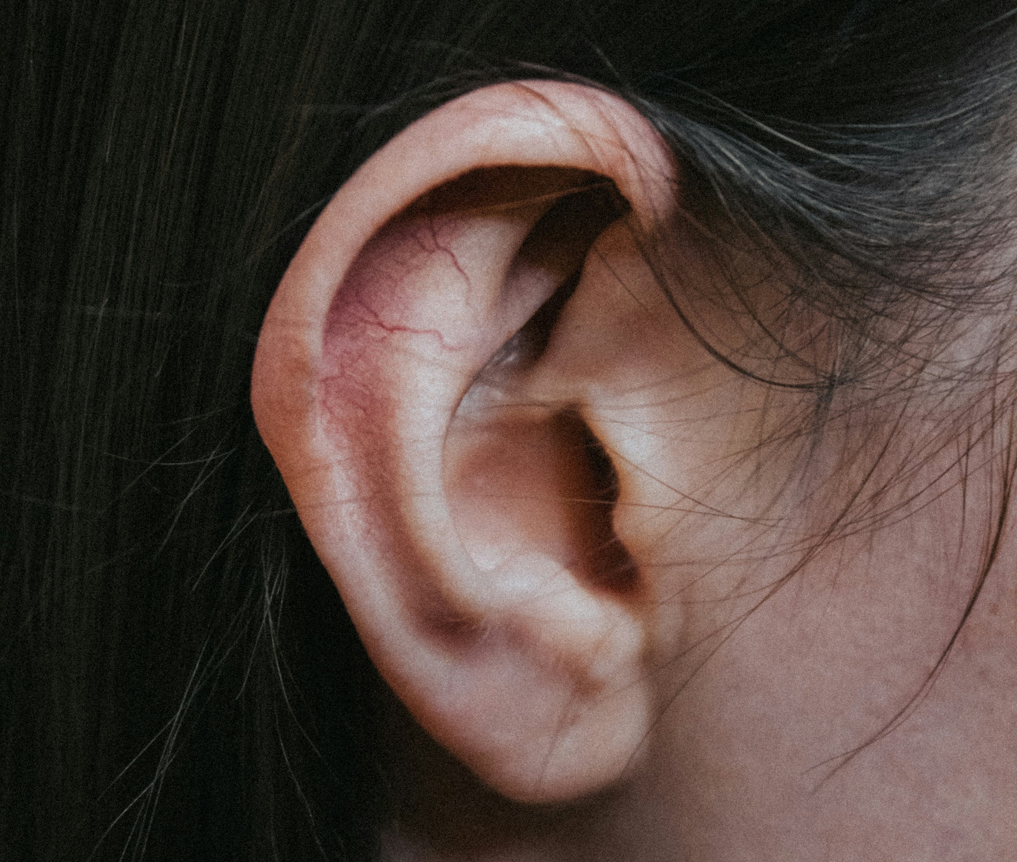 一名女子常挖耳朵，發現耳朵悶塞就診，醫師用內視鏡檢查，發現長了像香菇的耳黴，圖為示意圖。（翻攝自Pexels圖庫）