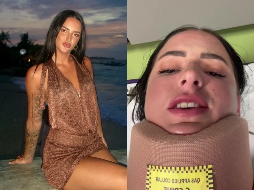 艾拉在TikTok上分享了一段慘痛的親身經歷，對全球駕駛發出嚴正警告。（翻攝自ella.carterrrr IG）