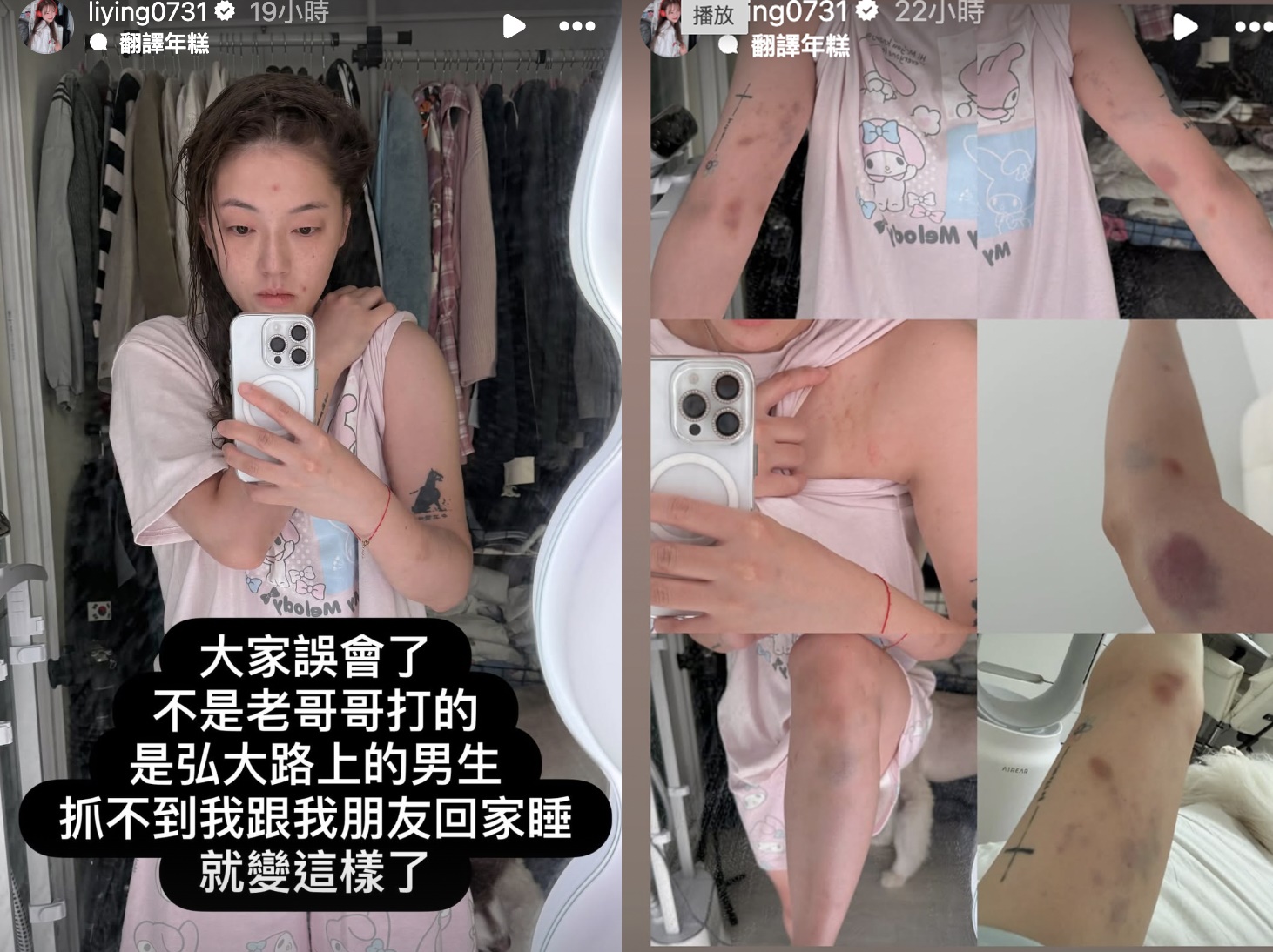 劉力穎透露，自己在韓國被打。（翻攝自IG＠liying0731）