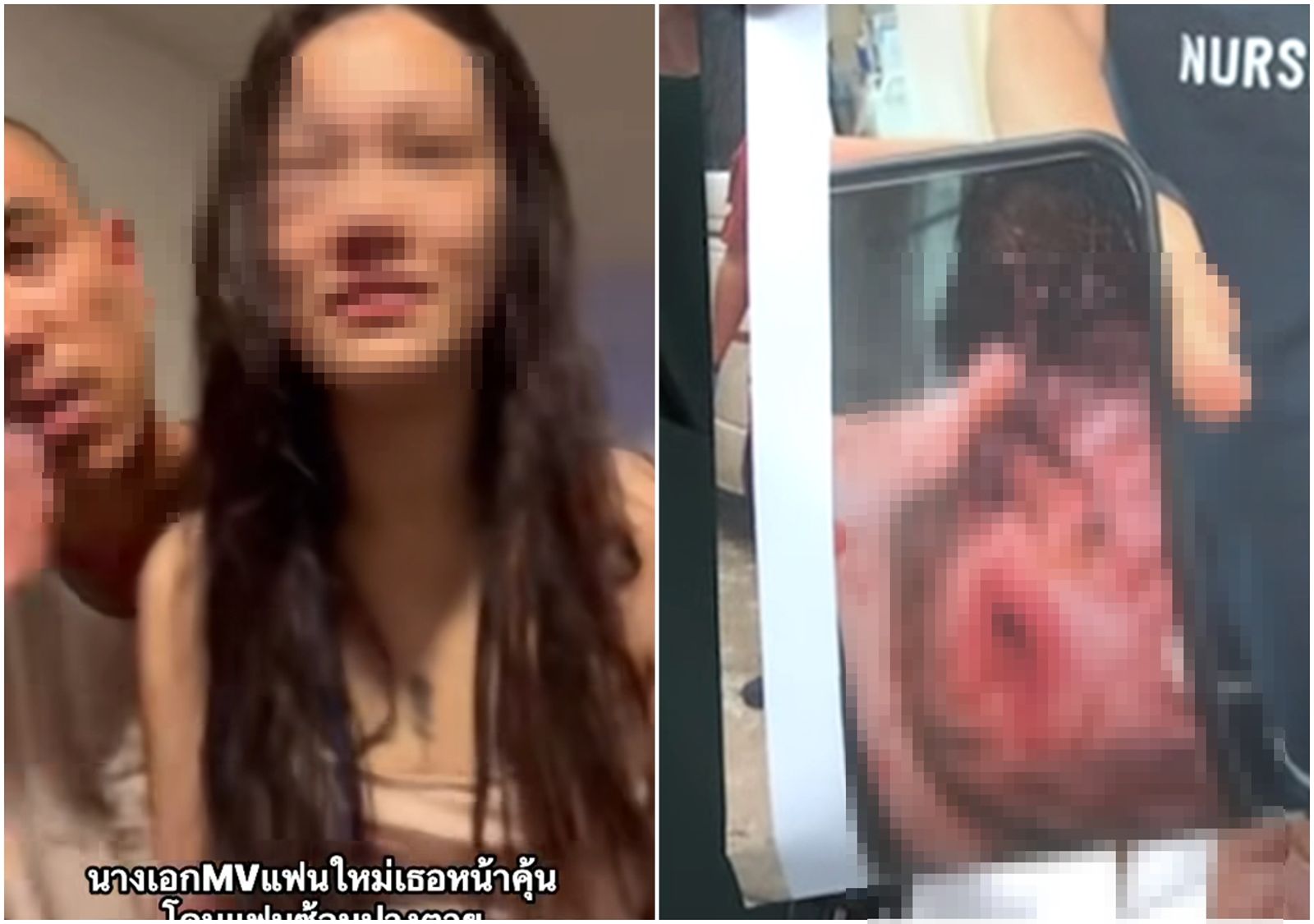 貝爾跟前男友提出分手後,遭受到一連串恐怖的暴力攻擊,她的頭部還有一個3公分左右孔洞傷口。(翻攝自臉書/โหนกระแสYT頻道)