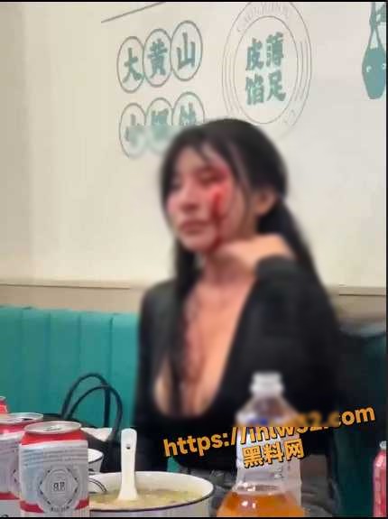 黑衣妹掛彩。（翻自《黑料網》）