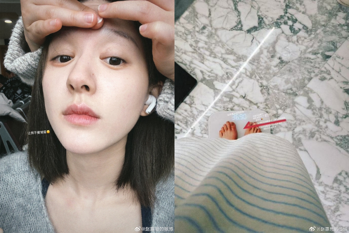 中國女星趙露思今（1日）重啟微博並以長文敘述自己的病情，秀出她僅36公斤的體重。（翻攝趙露思微博）