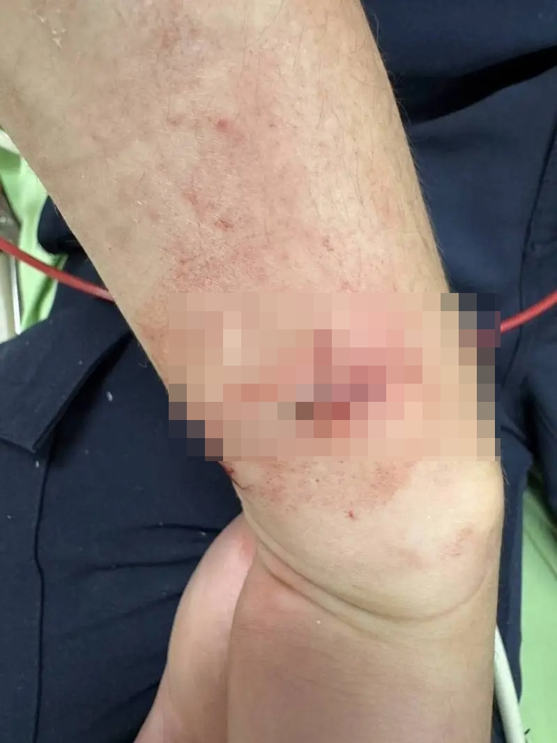 受傷員警隨後送醫縫合,所幸意識清楚並無生命危險。(翻攝畫面)