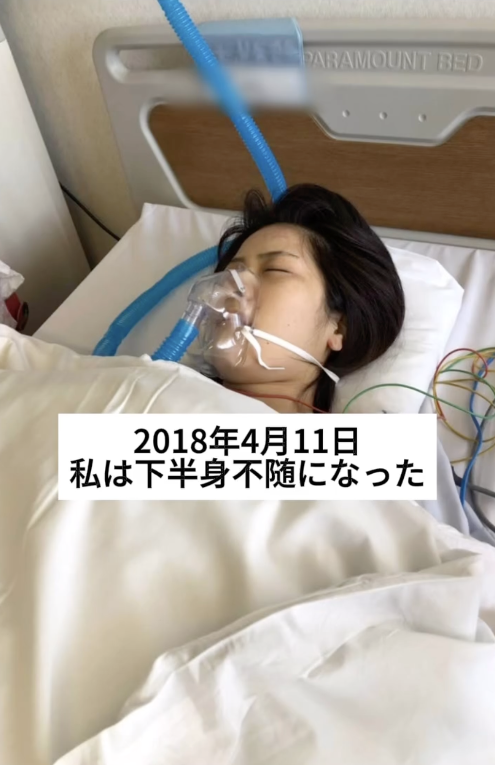 日女星豬狩友香從2018年4月11日被宣布下半身不遂,甚至無法自主排泄。(翻攝豬狩友香INS)