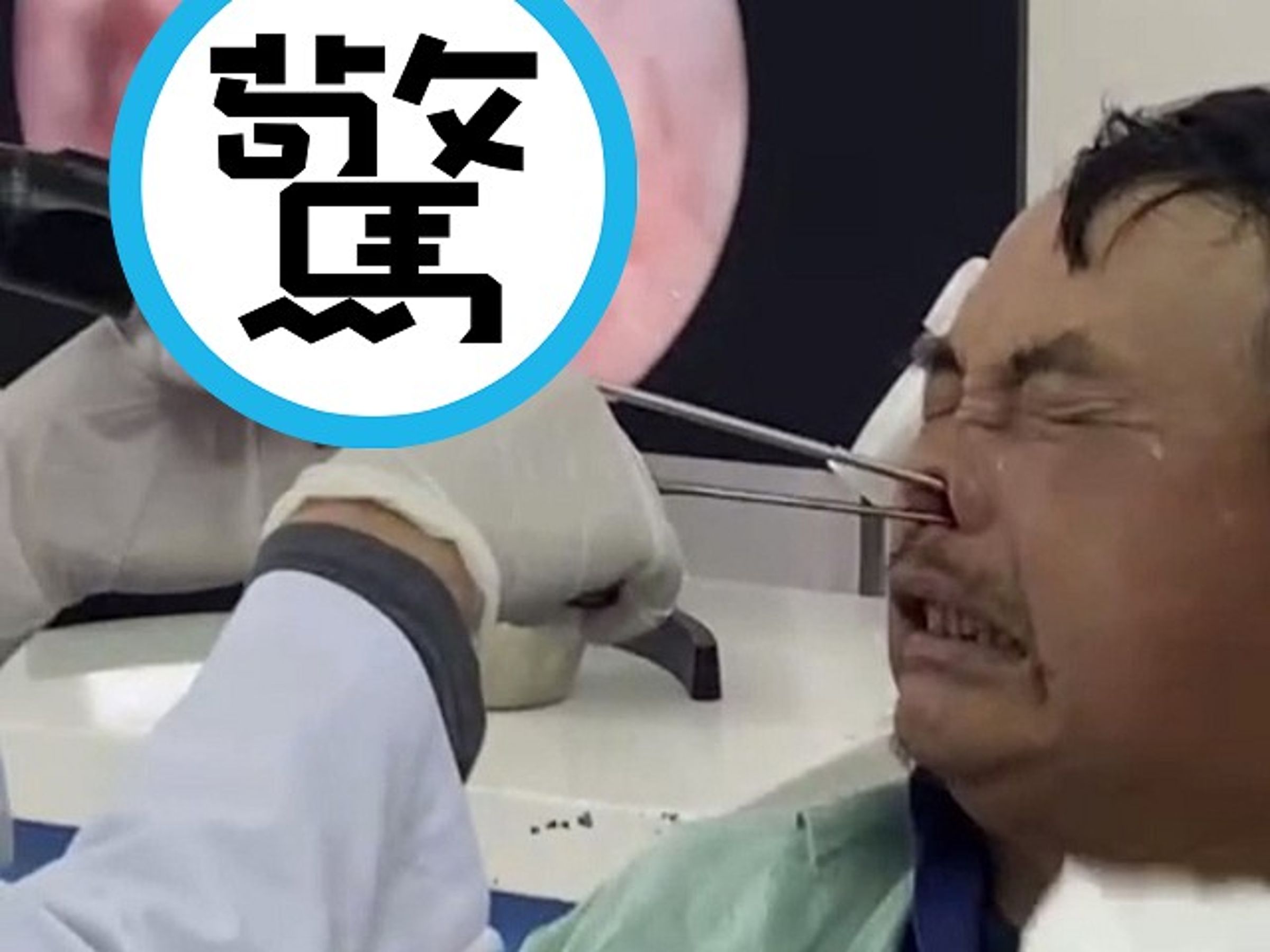 驚！男長期流鼻涕、鼻腔發臭，竟是100蛆蛆塞鼻還築巢。（翻自《中國報》）