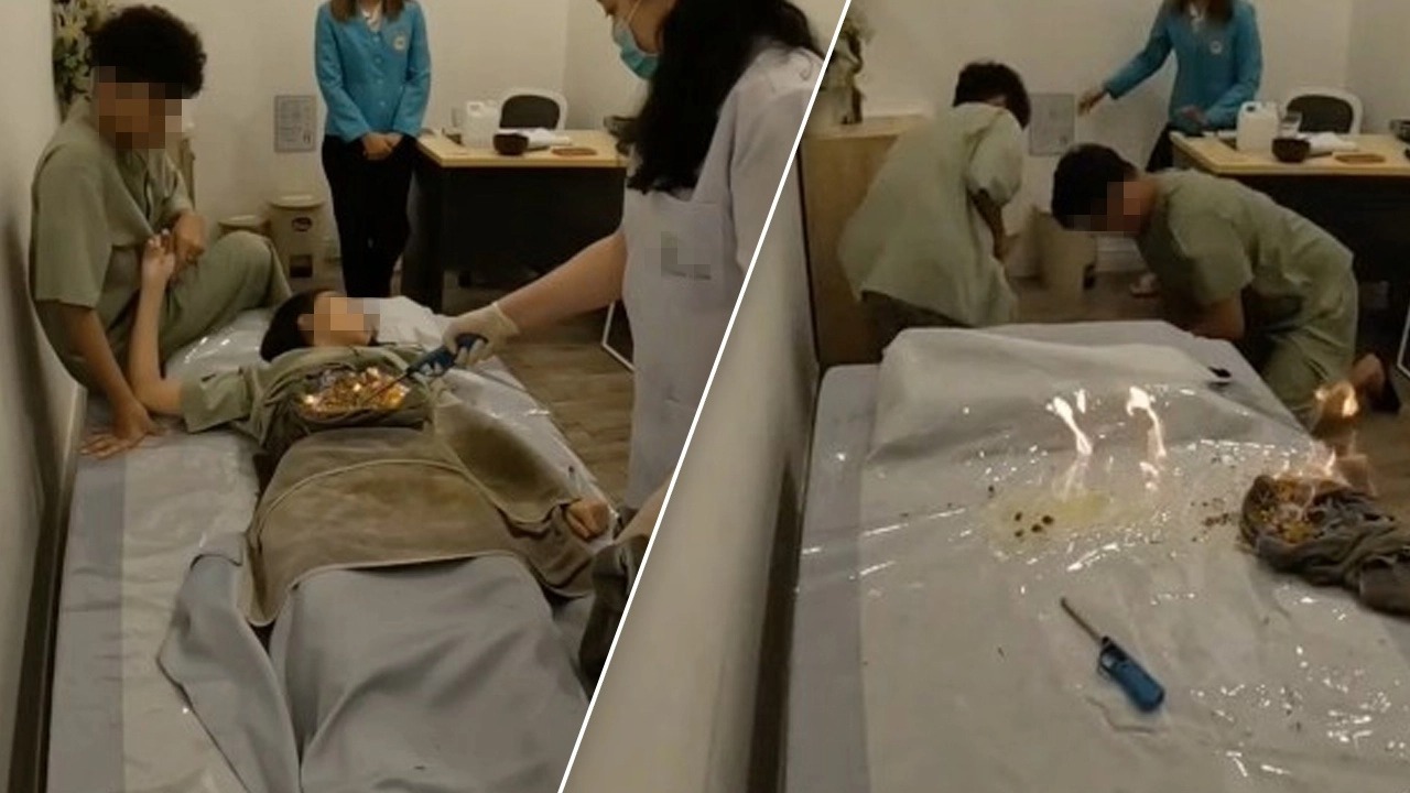 驚悚影片！泰網美做傳統療法「燒灸」，醫師一點火瞬間全身燃燒。（翻自《Thairath》）