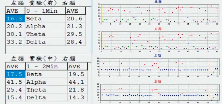 經10分鐘「調整」，業者秀出圖表告訴記者，「焦慮腦」的問題有明顯改善。