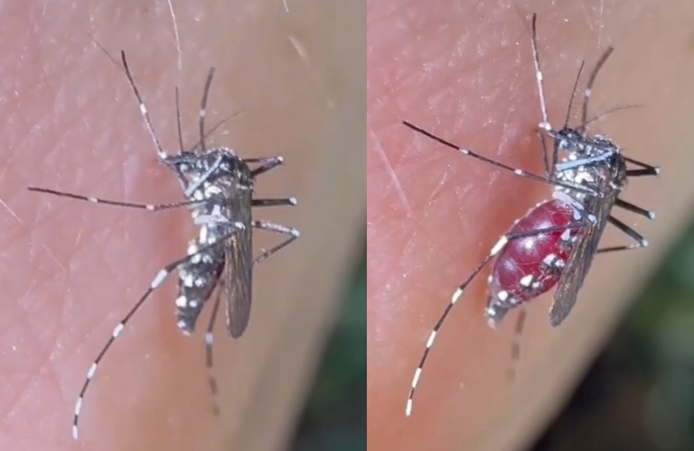 蚊子吸血前會先注射唾液麻痺神經，讓人感覺不到痛，進而吸血數分鐘，左圖牠用口器刺破人類皮膚，找到適合的血管後，開始一邊吸一邊過濾血液中的水分，慢慢變為右圖肚子吸飽血的樣子。（翻攝自微博）