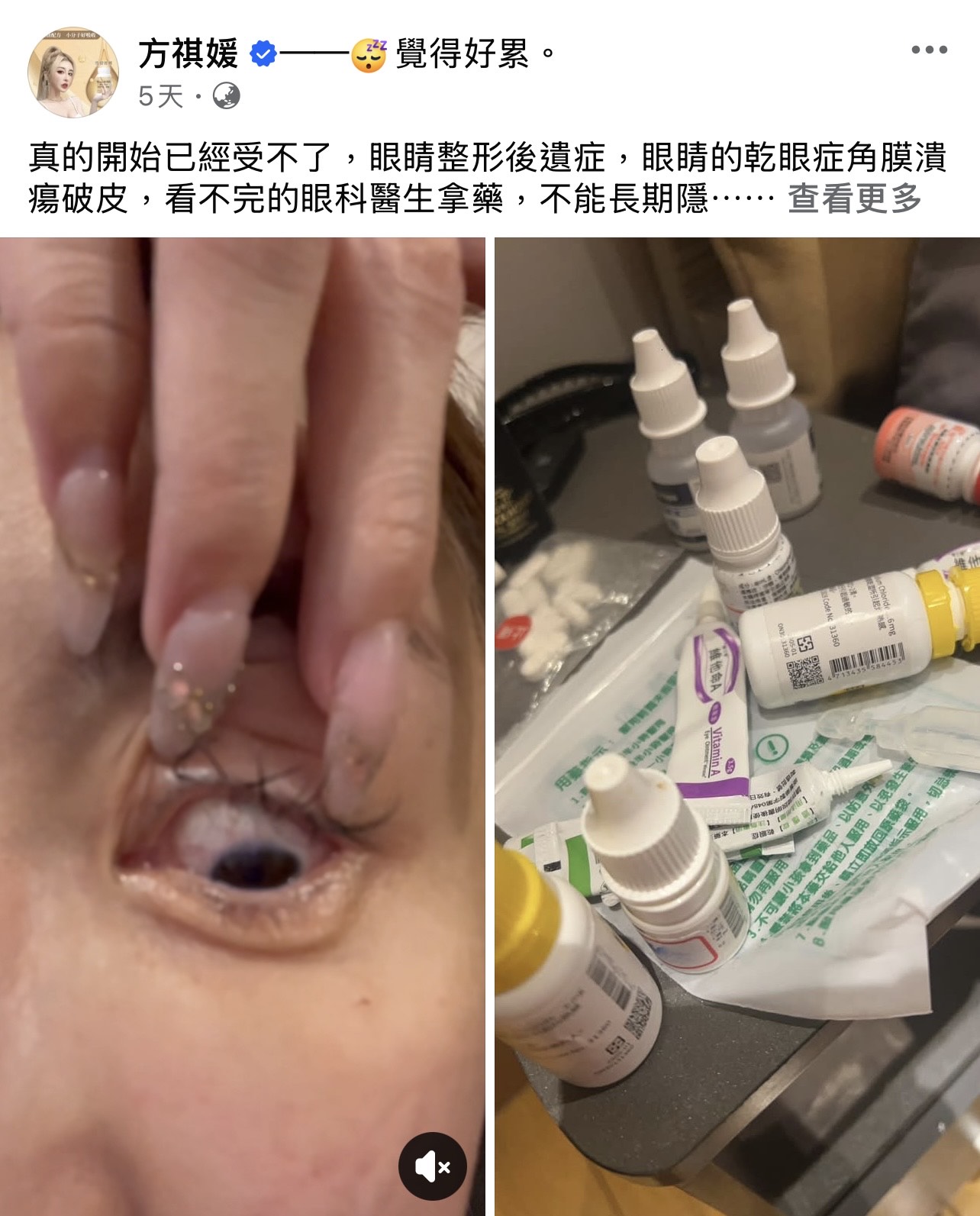 雪碧因「提眼肌太高」，頻頻掛號看眼科。（圖／翻攝自方祺媛雪碧臉書）