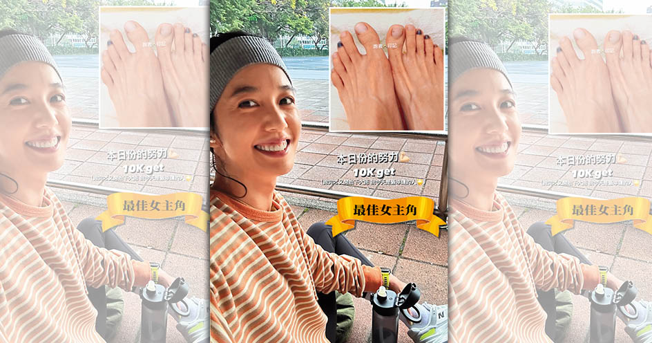 陳庭妮練馬拉松練到烏青，「最佳女主腳」不給她說不過去。（翻攝自陳庭妮IG）