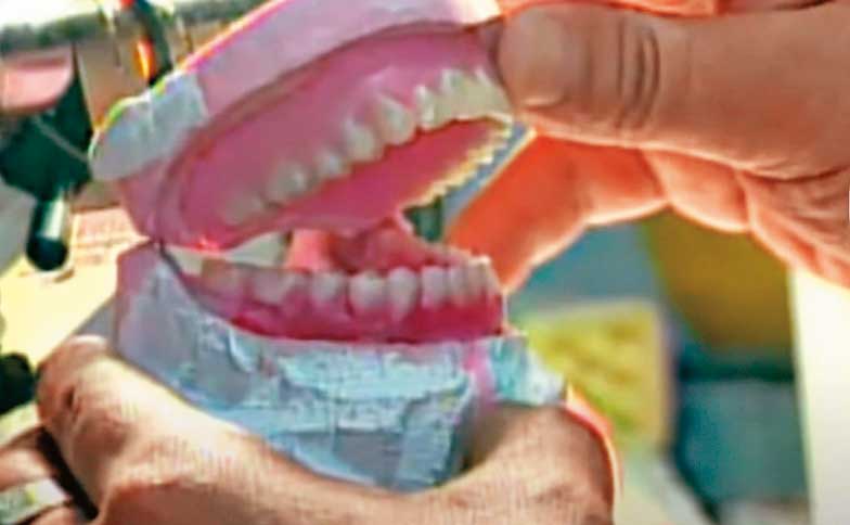 死者的丈夫是齒模師，一眼就認出白骨上的假牙為死者所有。（東森新聞提供）