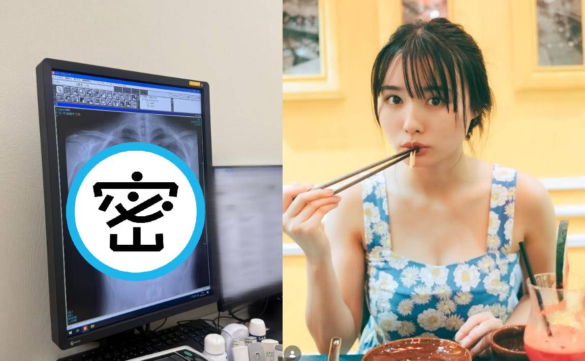 豐島心櫻在社群平台曬出胸部X光片，沒想到粉絲目光聚焦在完美胸型。（翻攝X@CocoroToyoshima、翻攝IG@cocorotoyoshima）