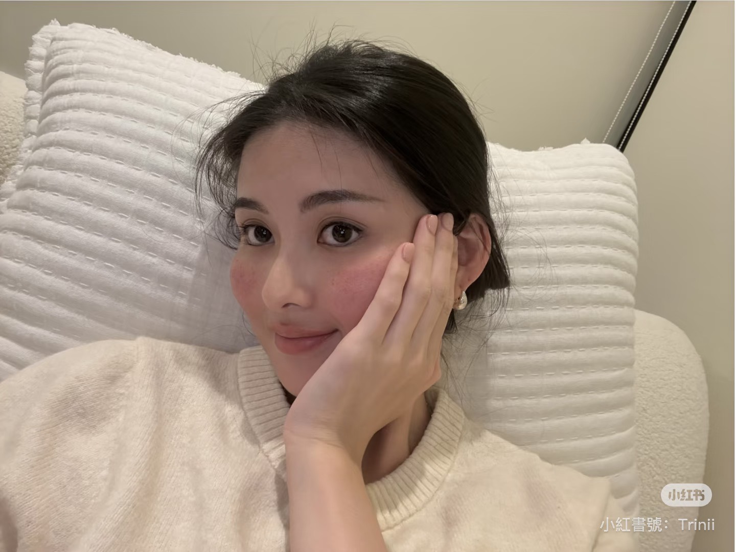 廖思惟卸妝後曬出素顏照，臉頰泛紅「玫瑰斑」發作，大方分享真實膚況。（翻攝Trinity廖思惟小紅書）